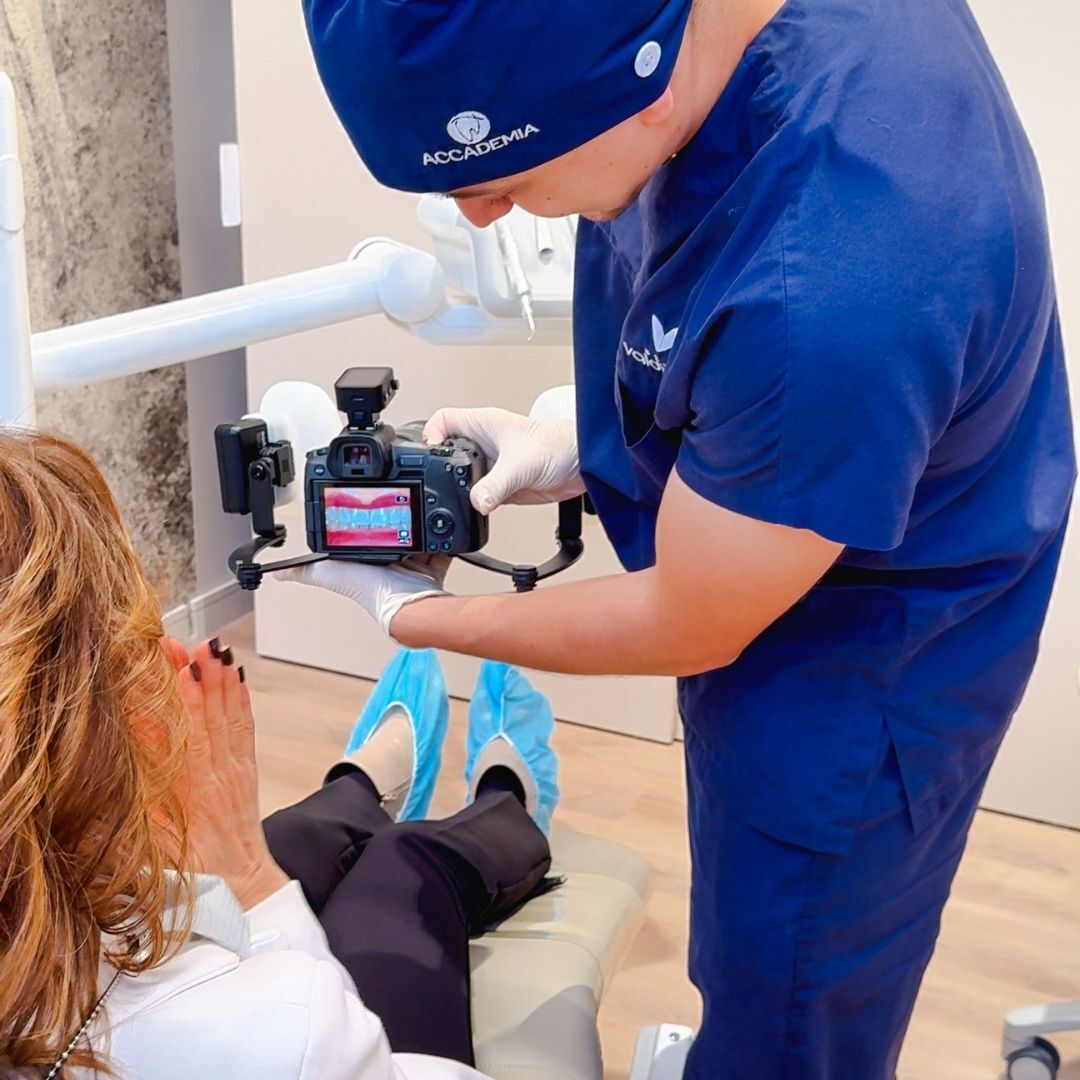 Faccette dentali a Forlì - Hollywood smile