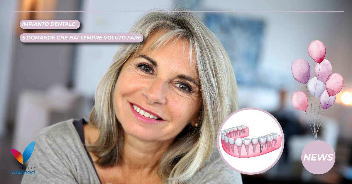impianto dentale | Studio Dentistico Valdinoci Forlì