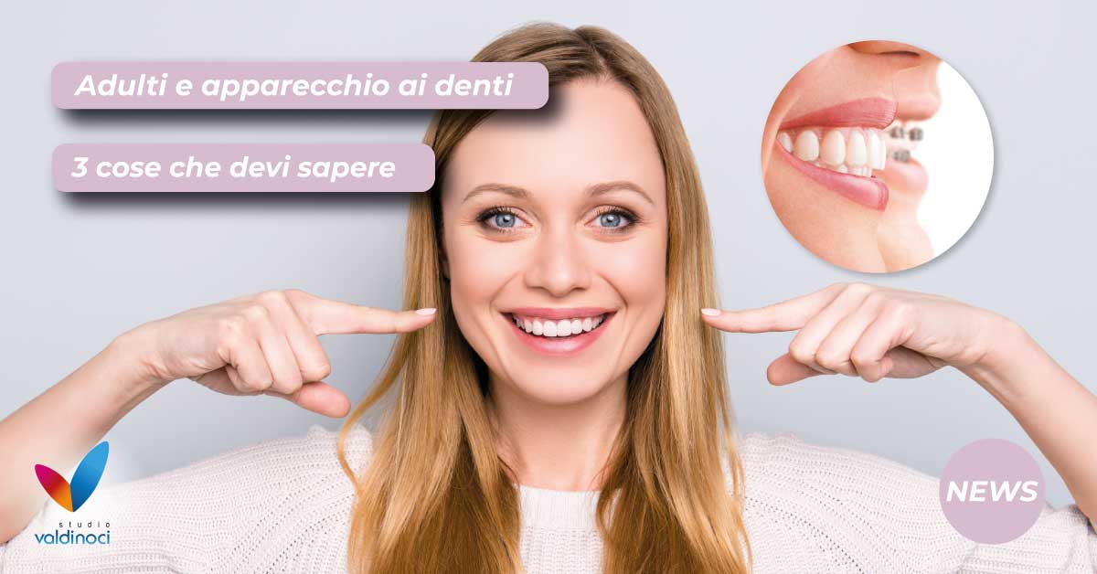 apparecchio-denti-adulti