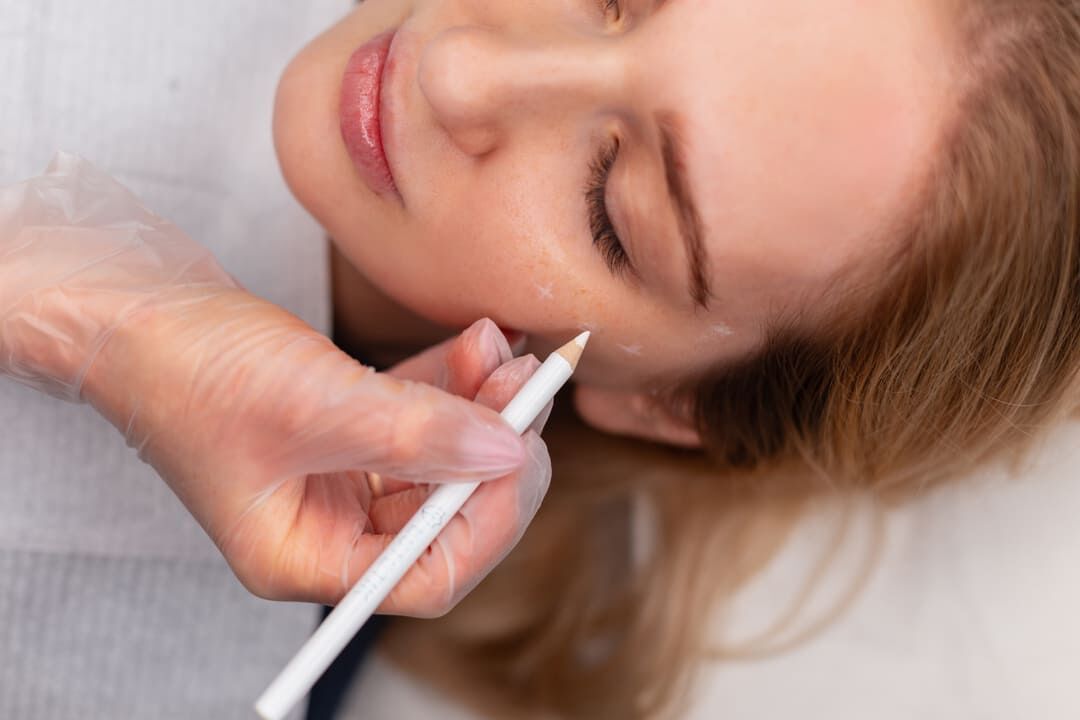 Biostimolazione - Valdinoci