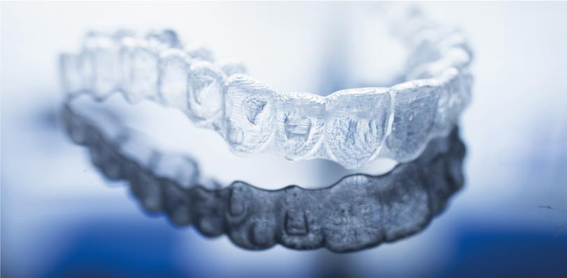 ortodonzia invisibile bambini