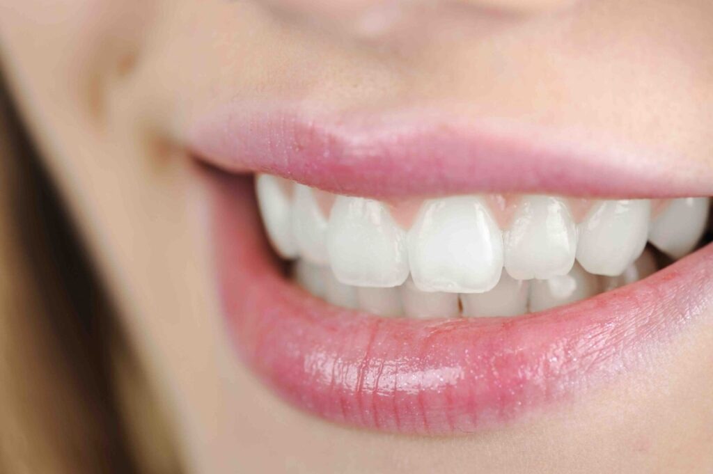 È doloroso lo sbiancamento dentale? Sensibilità, fastidio e cosa aspettarsi 1 è doloroso lo sbiancamento